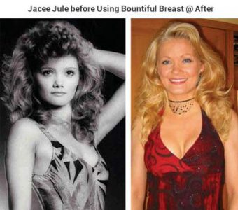 bountiful-breast-testimonials