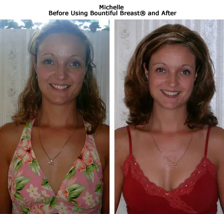 ba-michelle-enlarged (1)